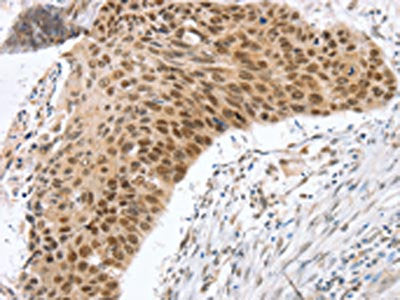 RNF20 Antibody