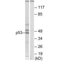 TP53 (Ab-378) Antibody