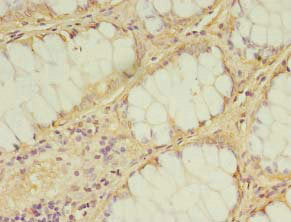 IDI2 Antibody
