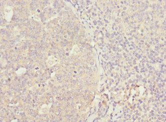 WNT5B Antibody