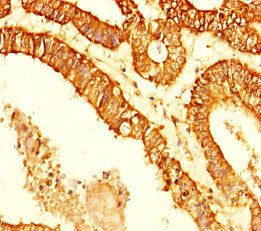 KDM4C Antibody