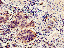 HIPK3 Antibody