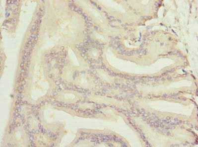 NOL6 Antibody