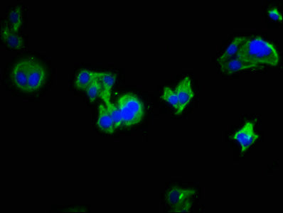 LRRC19 Antibody