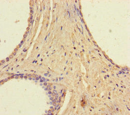 RAVER2 Antibody
