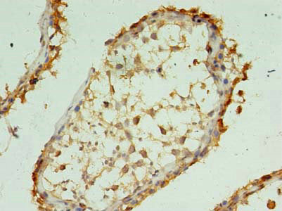 XAGE1A Antibody