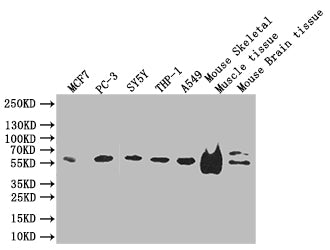 IFT46 Antibody