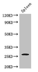 ZC4H2 Antibody