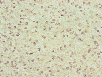 FBXO6 Antibody