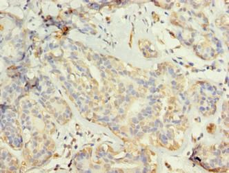 TUBG2 Antibody