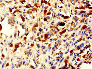 NHP2 Antibody