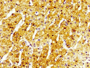 SIRT5 Antibody