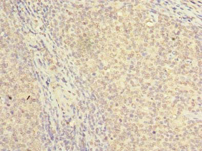 NKIRAS2 Antibody