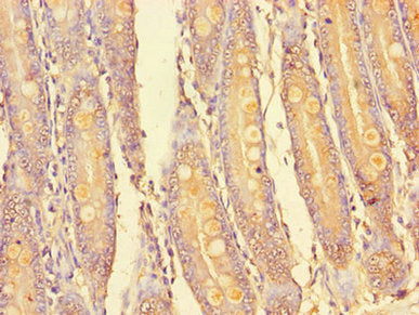 PIM2 Antibody