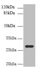 UTP23 Antibody
