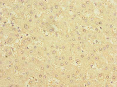 BDH2 Antibody