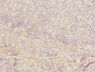 CDADC1 Antibody