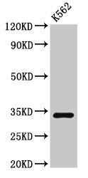 SET Antibody