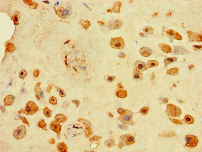 TINAGL1 Antibody