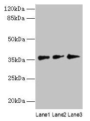 LDAH Antibody