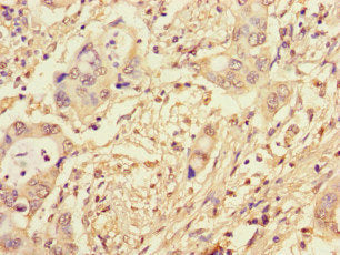 CWC22 Antibody