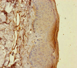 S100A14 Antibody