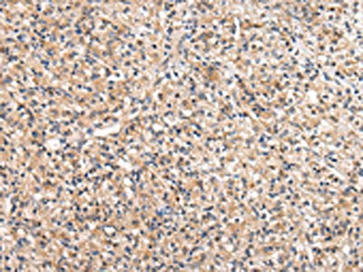 VIL1 Antibody