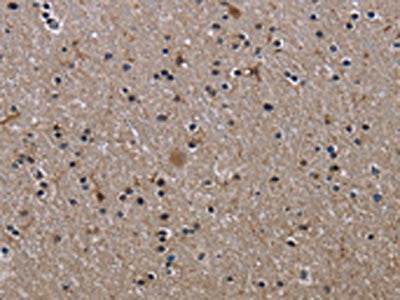 ITGB2 Antibody