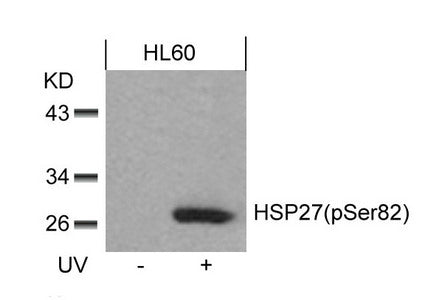 Phospho-HSPB1 (Ser82) Antibody