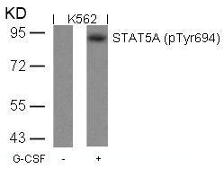 Phospho-STAT5A (Tyr694) Antibody