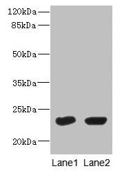 UBE2T Antibody