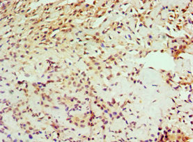 IL1RAP Antibody