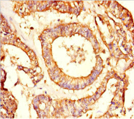 NRBP2 Antibody