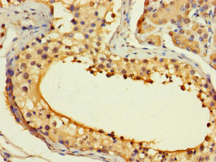 ASF1B Antibody