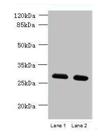 TMEM38B Antibody