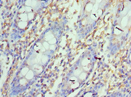 CD274 Antibody