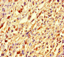 GMIP Antibody