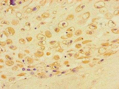 ACTR3 Antibody
