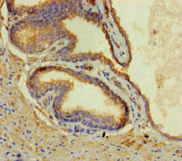 CORO1B Antibody