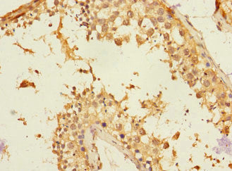 NTM Antibody