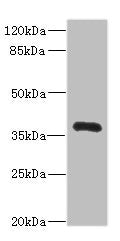 NTM Antibody