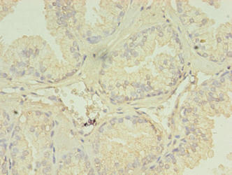 TRIM9 Antibody