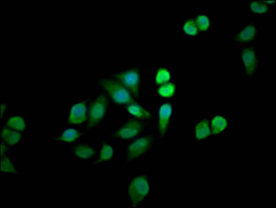 MTMR12 Antibody
