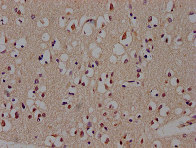 BCL11B Antibody