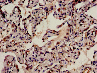BRD8 Antibody