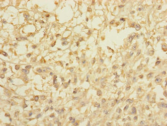 CCDC113 Antibody