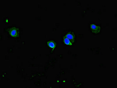 CCDC8 Antibody