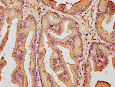 GLIPR2 Antibody