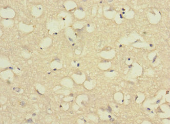 C11orf1 Antibody