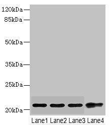 CSRP2 Antibody